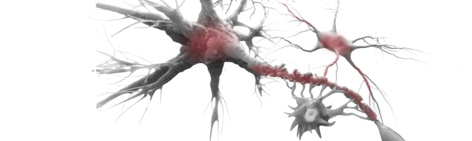 A black and white artistic rendering of an astrocyte and neurons with faint red coloration to suggest astrocyte reactivity.