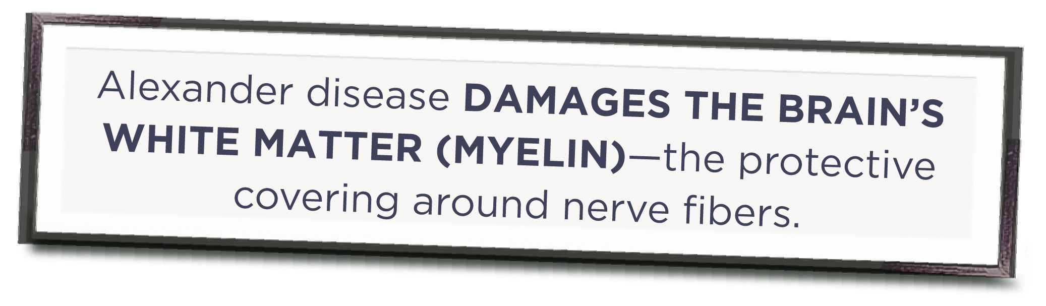 Poster with the phrase “Alexander disease damages the brain’s white matter (myelin)—the protective covering around nerve fibers.”